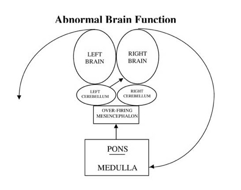 abnorm